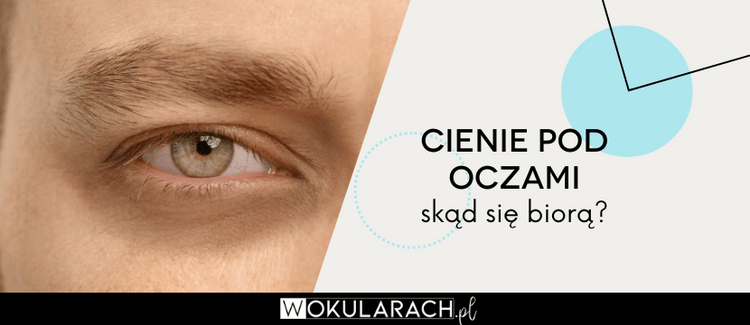 Cienie pod oczami - skąd się biorą?