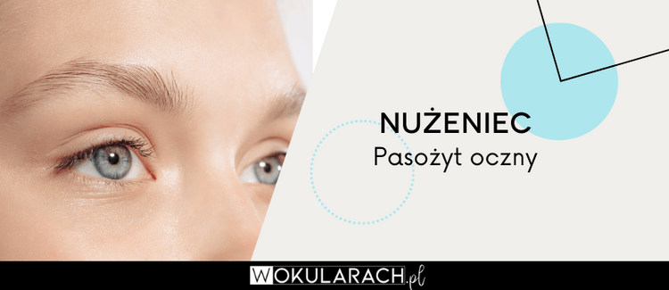 Nużeniec – pasożyt oczny 