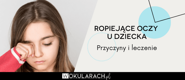 Ropiejące oczy u dziecka - przyczyny i leczenie