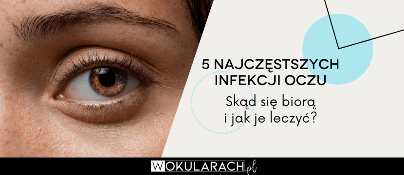 5 najczęstszych infekcji oczu – skąd się biorą i jak je leczyć?