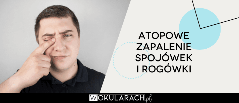 Atopowe zapalenie spojówek i rogówki