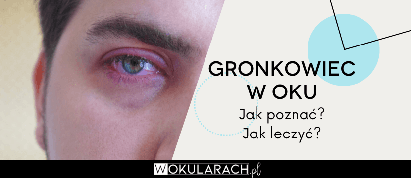 Gronkowiec w oku - jak poznać? Jak leczyć?