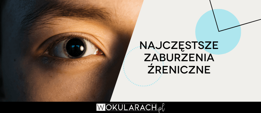 Najczęstsze zaburzenia źreniczne