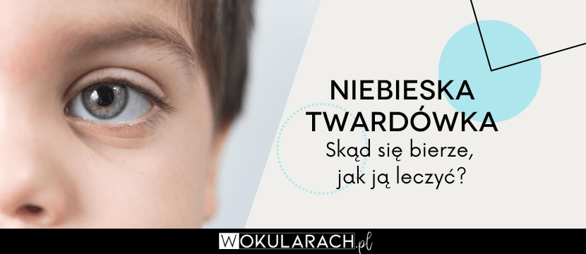 Niebieska twardówka – skąd się bierze, jak ją leczyć?
