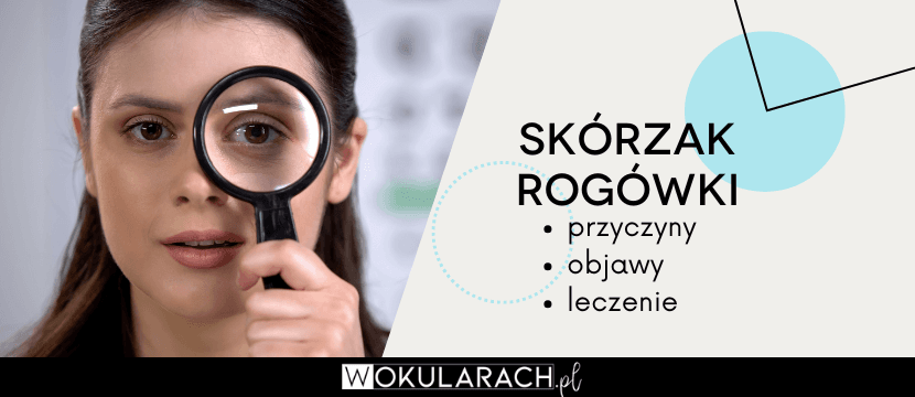 Skórzak rogówki – przyczyny, objawy i leczenie