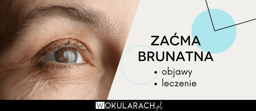 Zaćma brunatna - objawy, leczenie