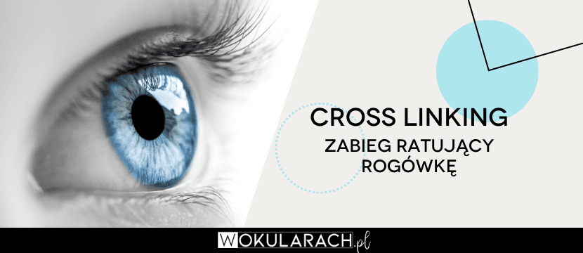 Cross linking - okulistyczny zabieg ratujący rogówkę