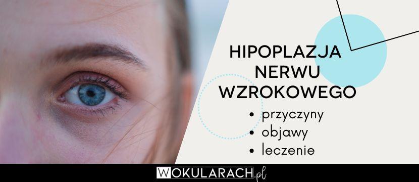 Hipoplazja nerwu wzrokowego – na czym polega?