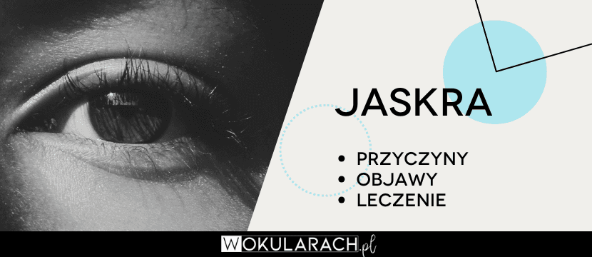 Jaskra – przyczyny, objawy, leczenie