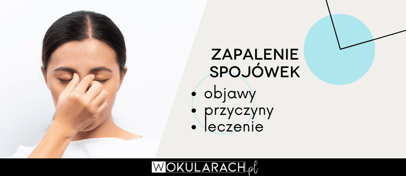 Zapalenie spojówek – objawy, przyczyny i leczenie