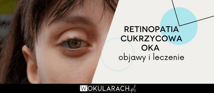 Retinopatia cukrzycowa oka - objawy i leczenie