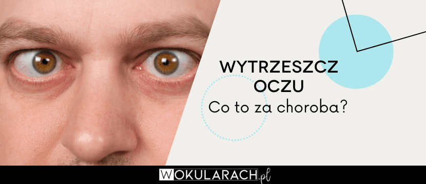 Wytrzeszcz oczu – co to za choroba?